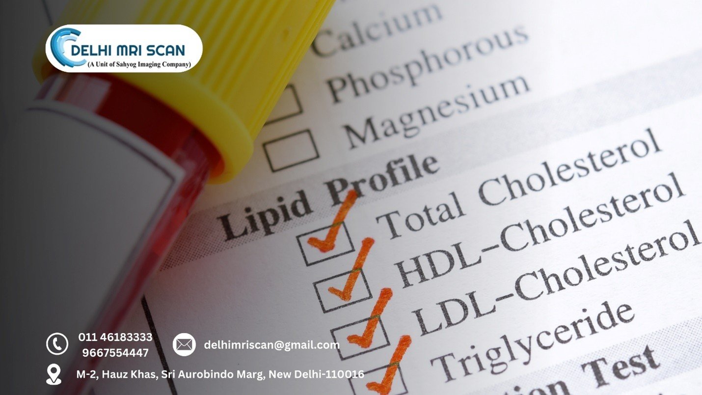 lipid-profile-test-in-south-delhi